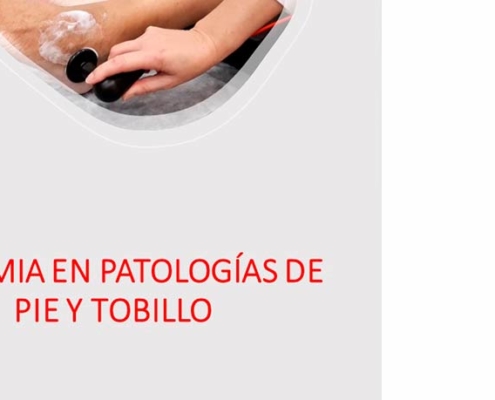 curso diatermia tratamientos de patologias pie y tobillo x