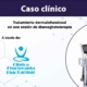 caso-clinico-bomba-diamagnetica-fisiokarmar-tratamiento-dermatofuncional-portada