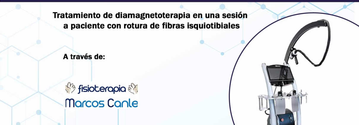 Tratamiento de diamagnetoterapia en una sesión a paciente con rotura de fibras isquiotibiales