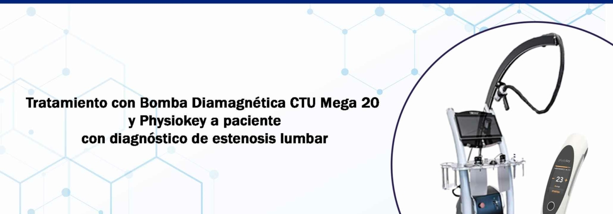 testimonio bomba diamagnetica estenosis lumbar portada x