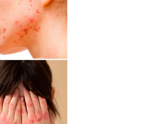 curos tratamientos dermatofuncionales  septiembre banner zoom x